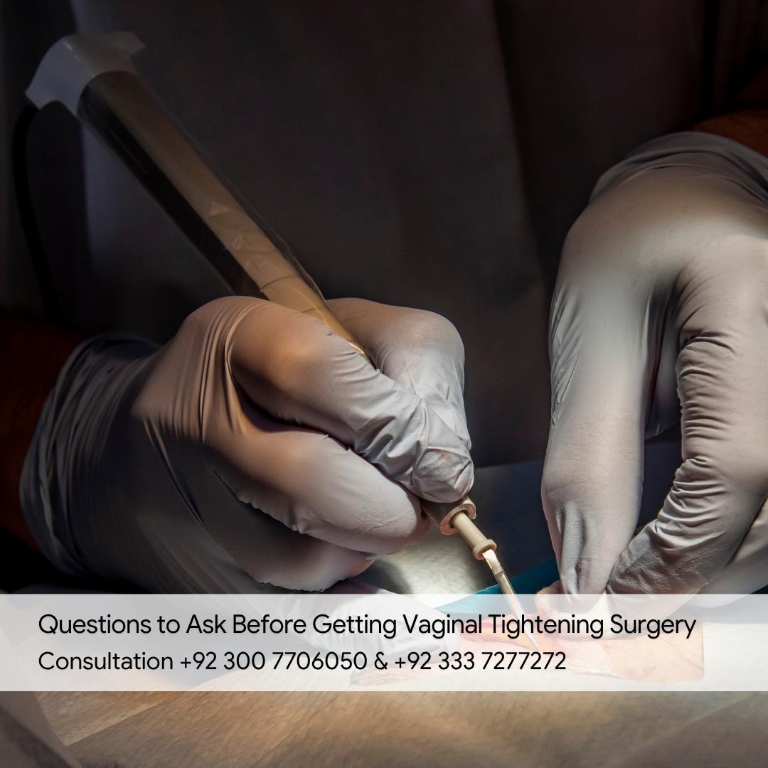 Questions to Ask Before Getting Vaginal Tightening Surgery