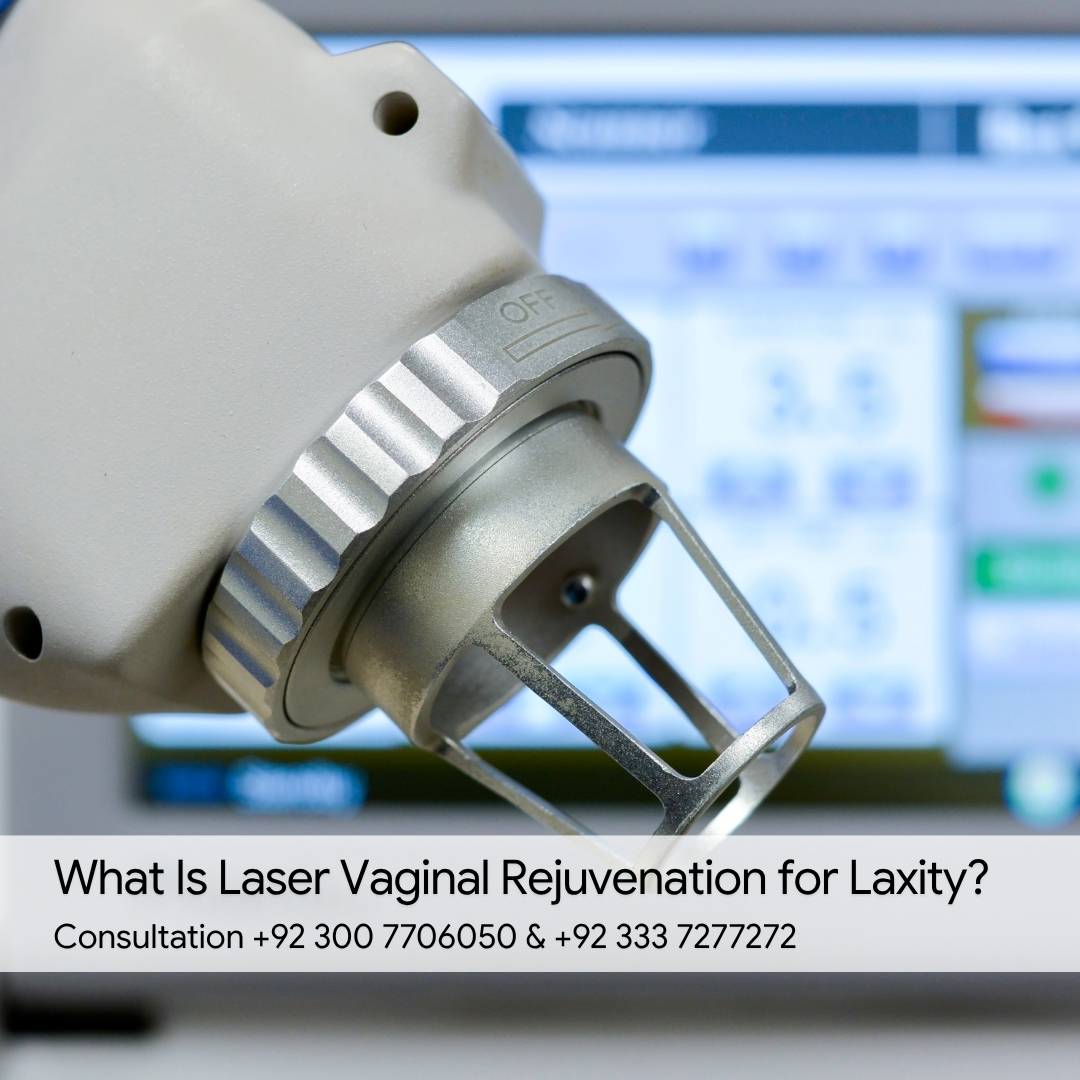 What Is Laser Vaginal Rejuvenation for Laxity