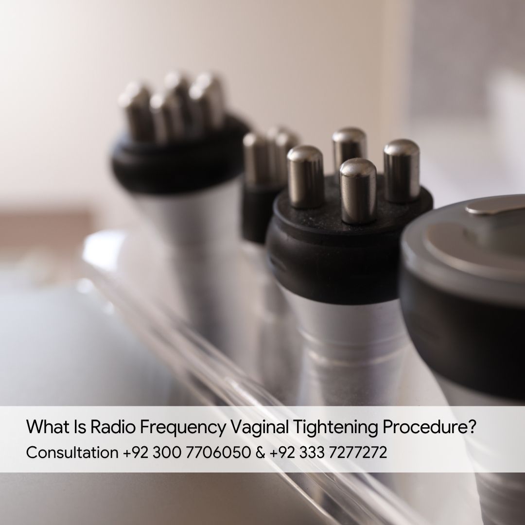 What Is Radio Frequency Vaginal Tightening Procedure