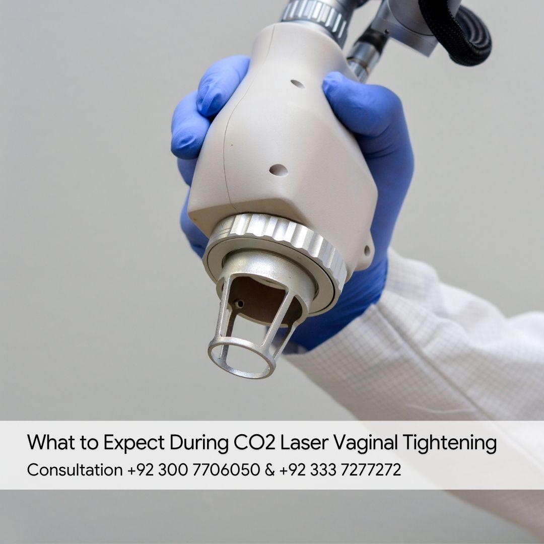 What to Expect During CO2 Laser Vaginal Tightening