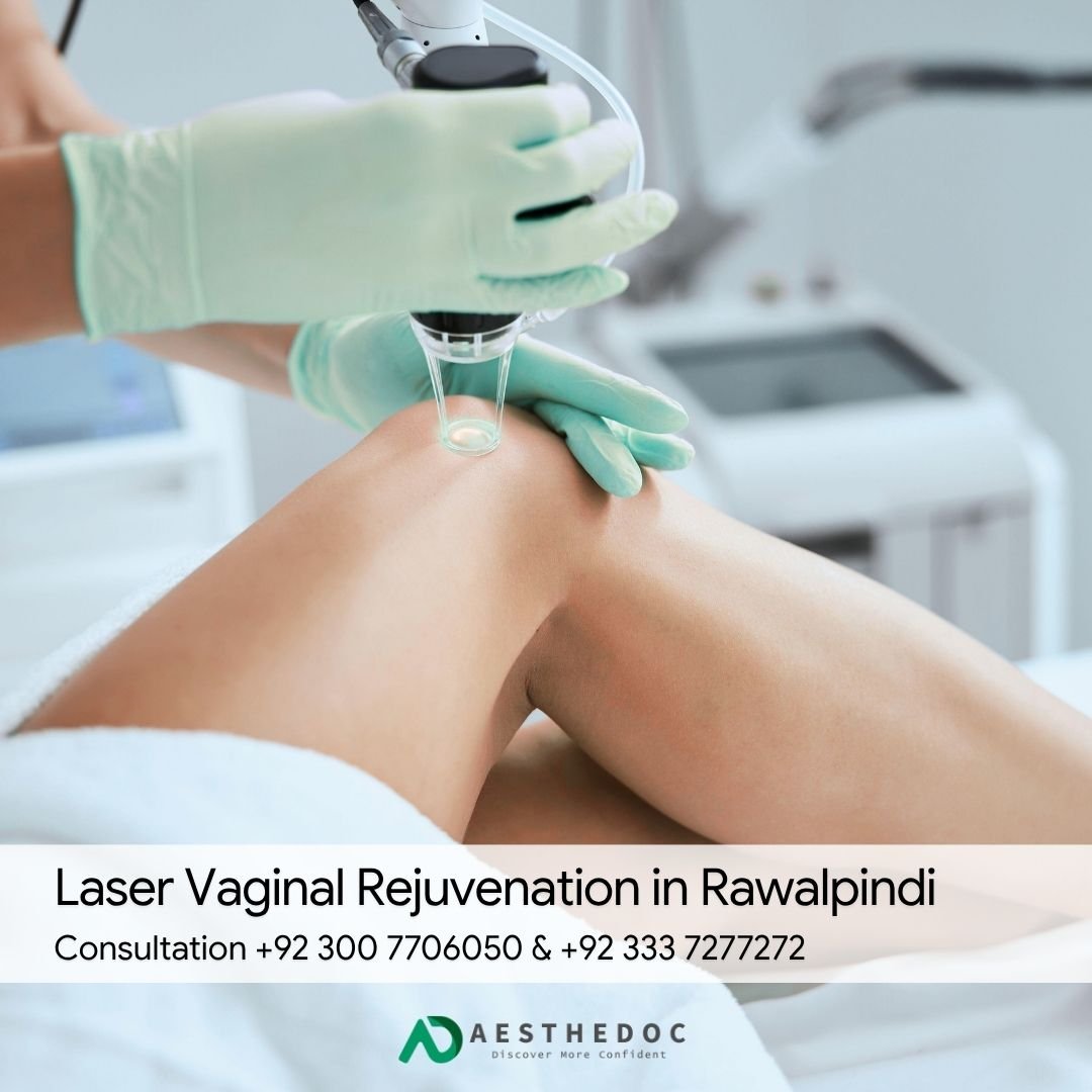 Laser Vaginal Rejuvenation in Rawalpindi
