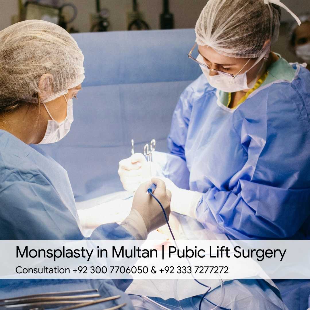 Monsplasty in Multan Pubic Lift Surgery
