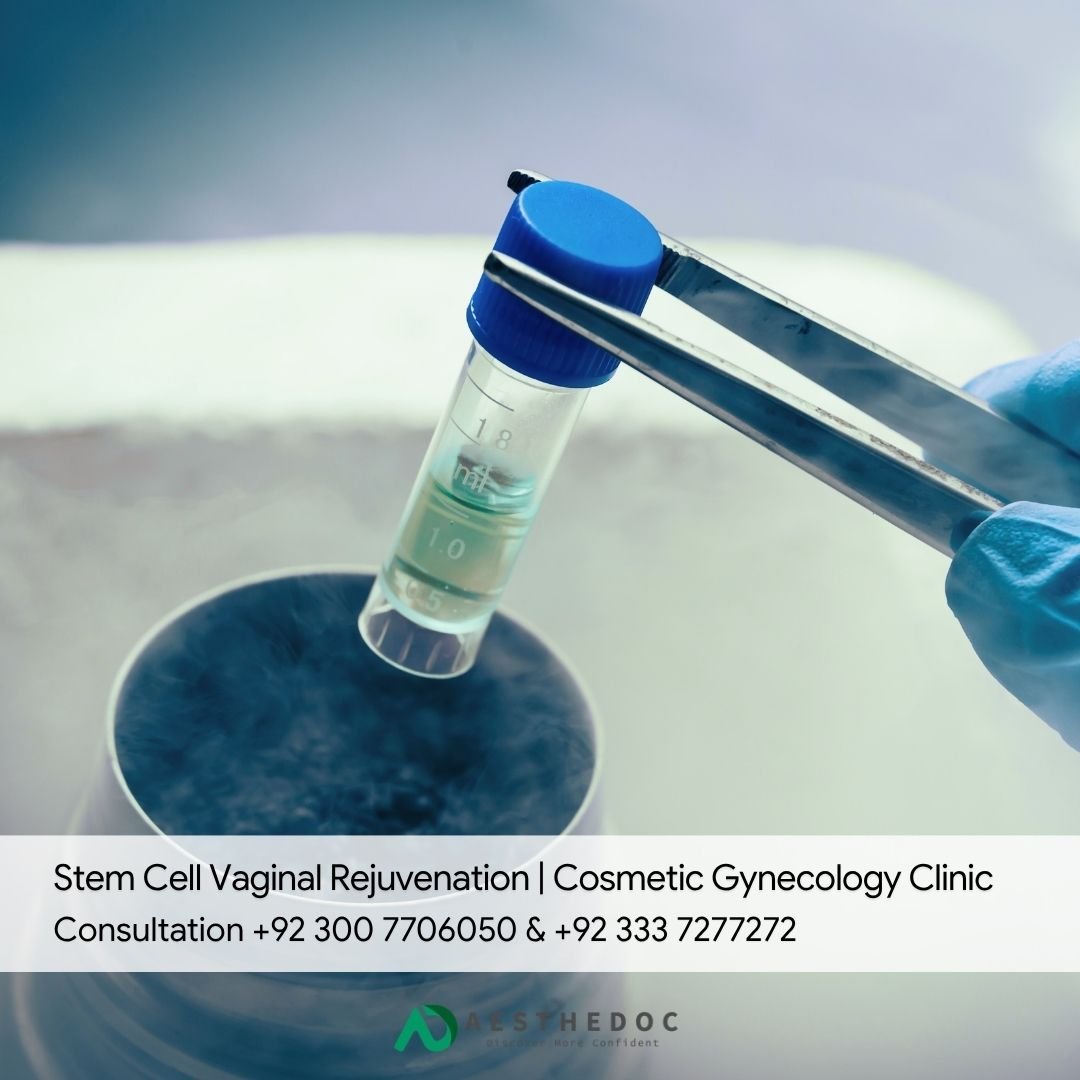 Stem Cell Vaginal Rejuvenation